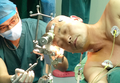 我院神经外科与麻醉科精诚合作成功完成福建省第一例术中唤醒手术