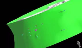 我院介入科成功开展福建首例3D打印模板引导下的放射性粒子植入手术