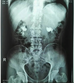 我院第六批援宁医疗队获“援固先进医疗队”荣誉称号高锐同志荣获“援固医疗队优秀队长”称号