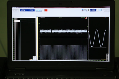 福建首台、全国第六台ROSA机器人落户附一医院，已成功连续开展手术
