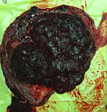 产房8分钟：一场生死时速的较量