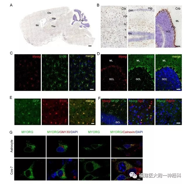国际神经科学领域顶级期刊“Neuron”发表我院陈万金团队最新研究成果——发现原发性家族性脑钙化症首个隐性遗传致病基因