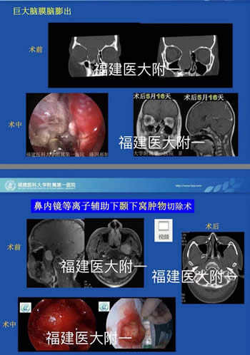 我院耳鼻咽喉科入选中国医师协会（鼻科+咽喉科）内镜培训基地