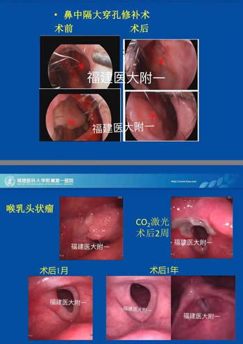 我院耳鼻咽喉科入选中国医师协会（鼻科+咽喉科）内镜培训基地