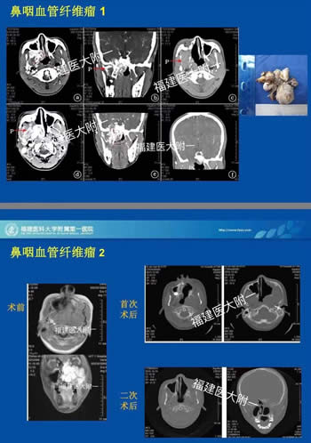 我院耳鼻咽喉科入选中国医师协会（鼻科+咽喉科）内镜培训基地