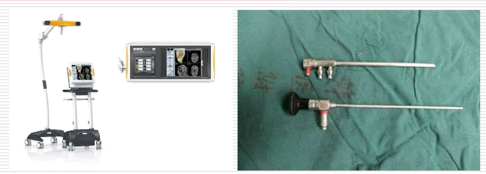 穿越“束”缚　精准“窃”除——我院神经外科应用功能神经导航辅助下Endoport内镜新技术为患者成功切除脑深部海绵状血管瘤