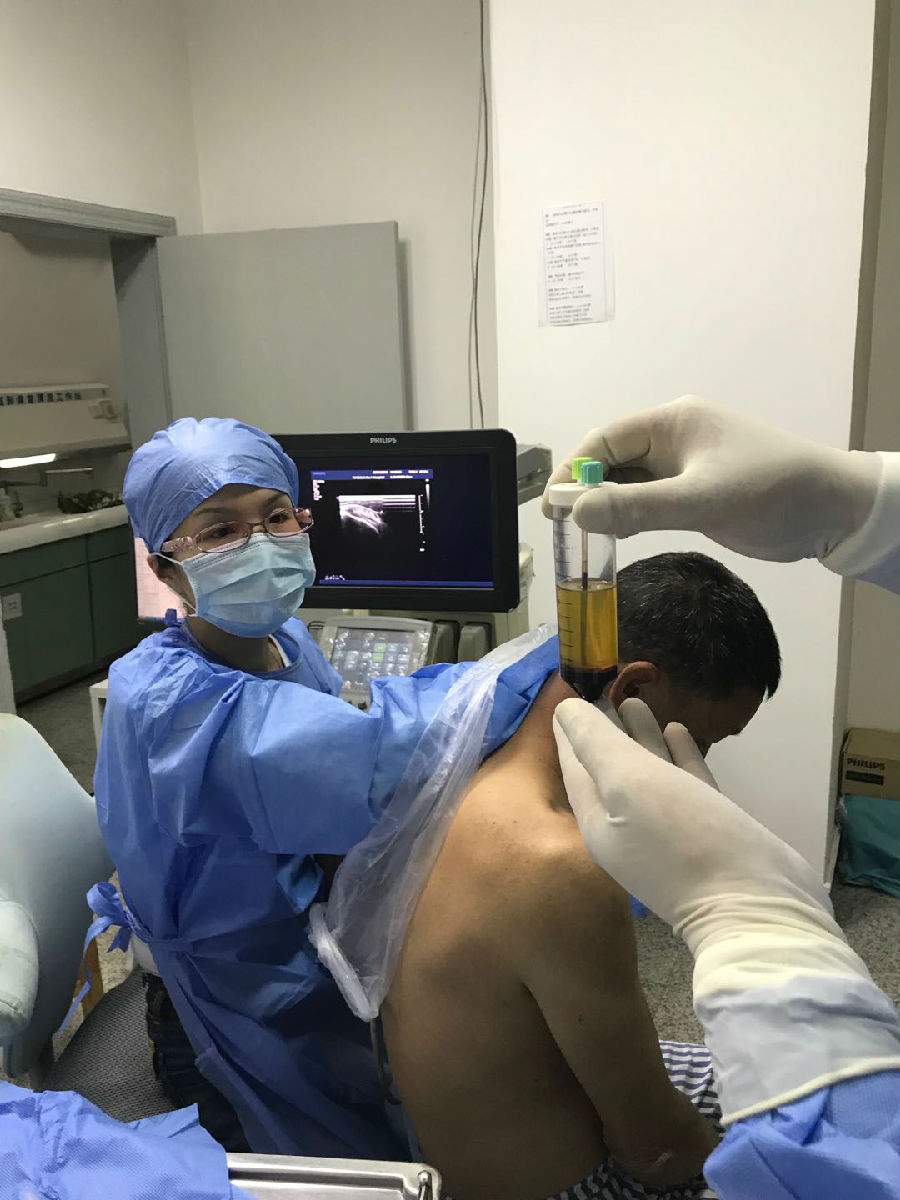 人体自带的神奇修复血浆PRP ——缓解关节疼痛，修复肌腱损伤，加速创面愈合