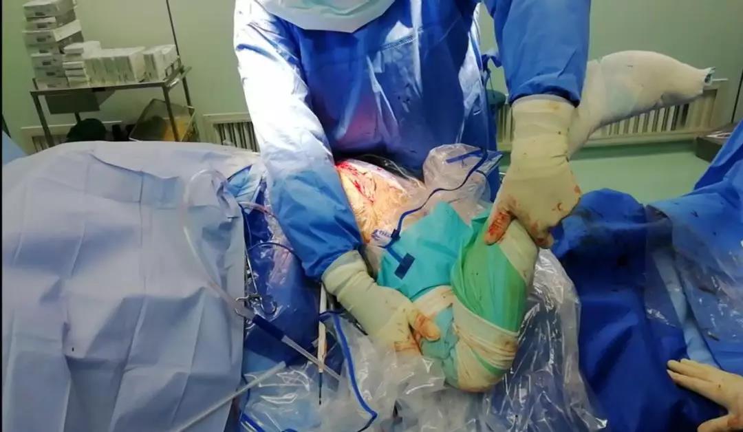 『媒体看附一』全副武装 医生穿“太空服”做手术