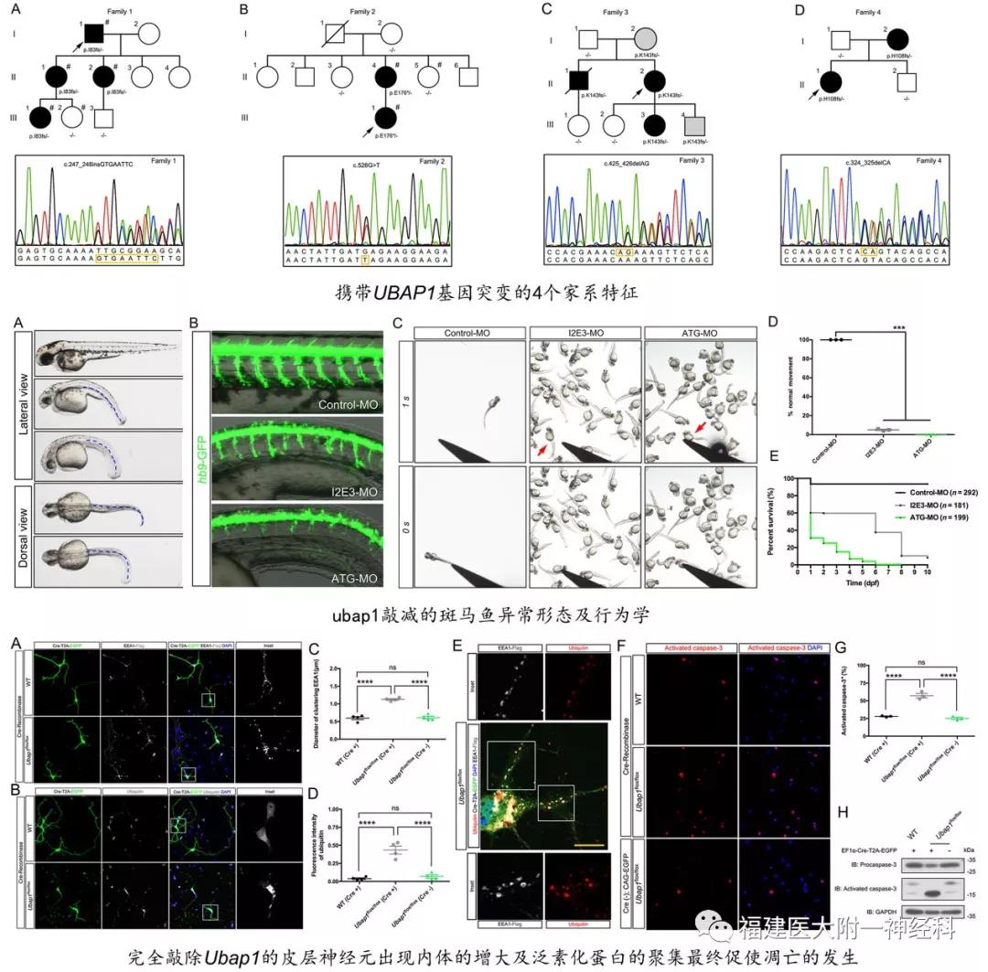 我院陈万金教授和王柠教授团队发现 遗传性痉挛性截瘫新亚型及新致病基因