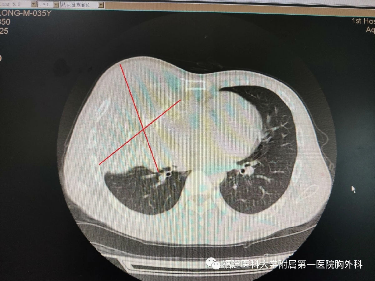 “拆弹”专家的“艺术品”