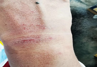 冲锋前线 只为救人 —— 感染科抗疫纪实