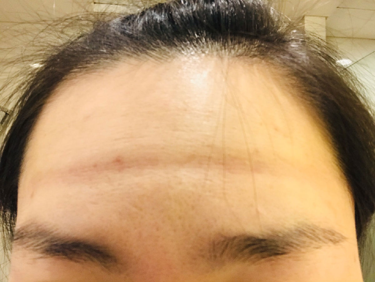 内镜中心沈嘉昕援鄂抗疫日记