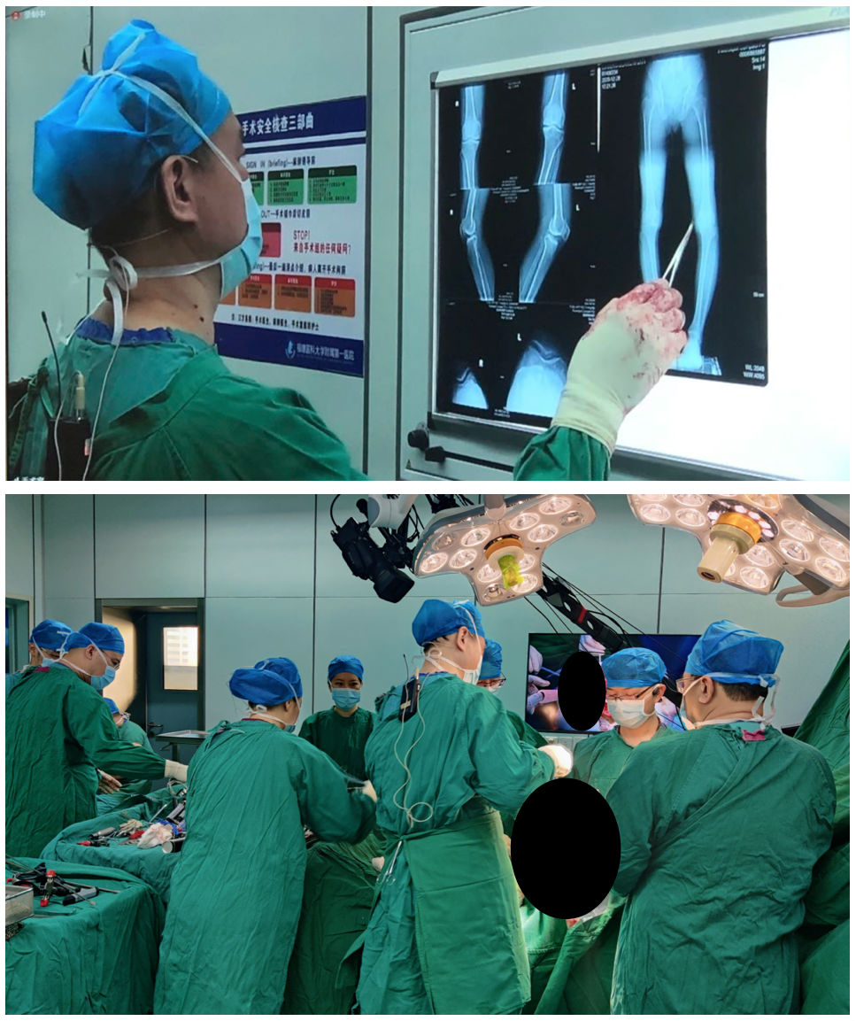 我院关节外科团队成功举办JOTV关节置换与翻修手术全国直播暨全省关节置换规范化学习班