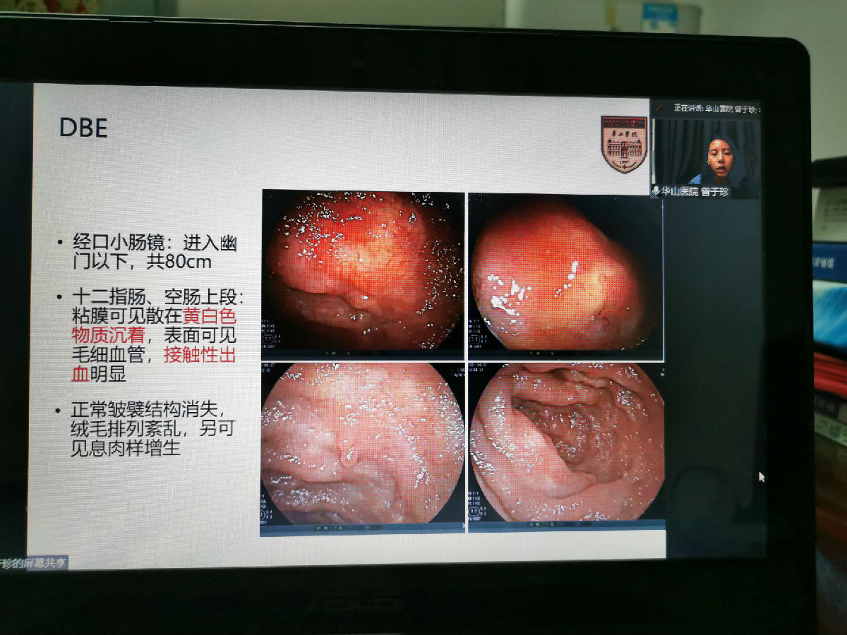 聚焦小肠疾病 尽享学术盛宴——2021华福消化论坛召开