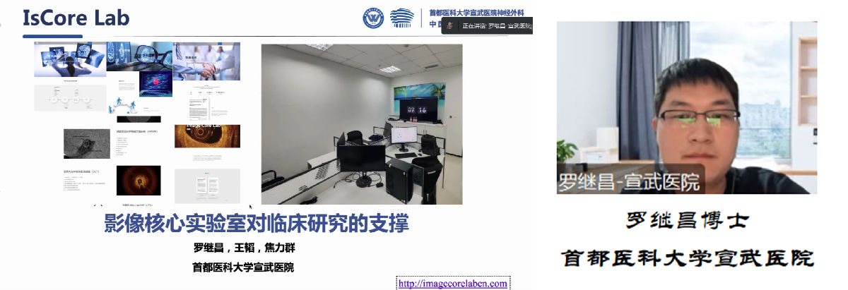 我院神经内科举办脑血管病学术交流会